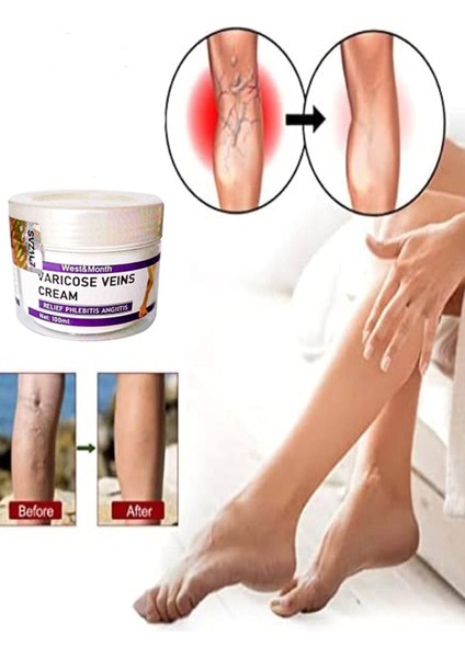 Varix Varicose Veins Purple Bakım Kremi 100 ml