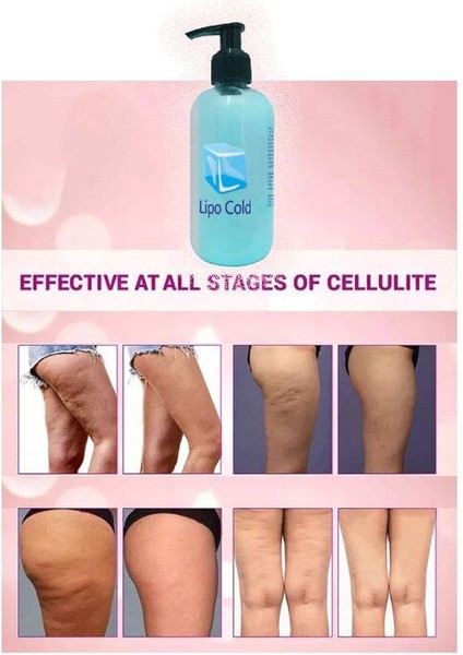 Lipo Cold Seliülitlerinize&fazlalıklarınıza Karşı Bakım Kremi 250 ml x 2 Adet fiyatları