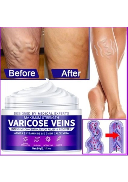 Strength Varicose Vein Tedavi Kremi 100 ml x 2 Adet fiyatları