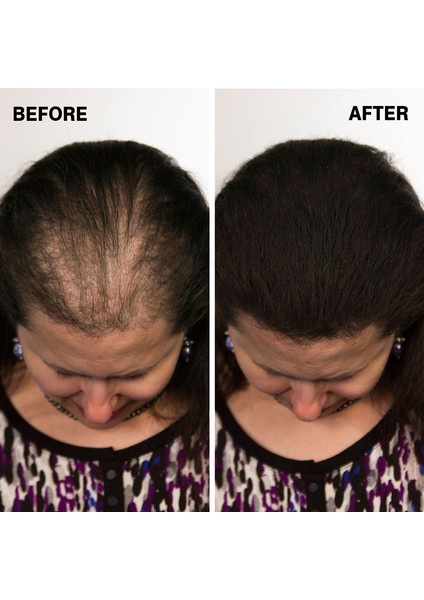 Dr Dermo Hair Saç Kapatıcı Dolgunlaştırıcı Sıvı Krem 30 ml