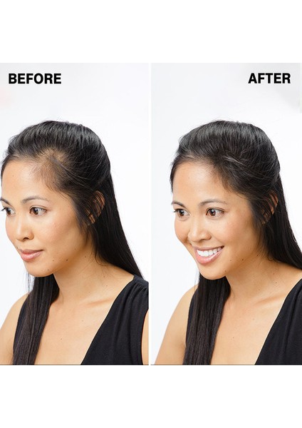 Dr Dermo Hair Saç Kapatıcı Dolgunlaştırıcı Sıvı Krem 30 ml