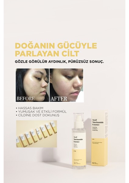 Snail Niacinamide Essence 100ML, Salyangoz Özlü Aydınlanma, Leke Karşıtı ve Cilt Onarıcı Yüz Serumu modelleri