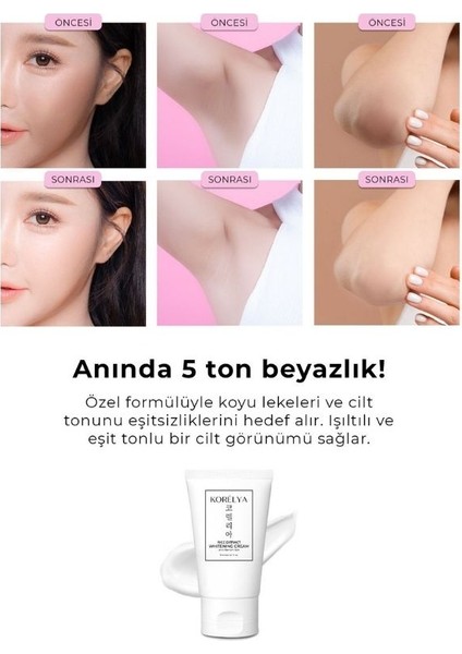 Pirinç Mayası Leke Karşıtı Beyazlatıcı Krem - Rice Yeast Whitening Cream 50 ml indirimleri