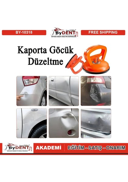 Pdr Boyasız Göçük Düzeltme Saplı Vantuz modelleri