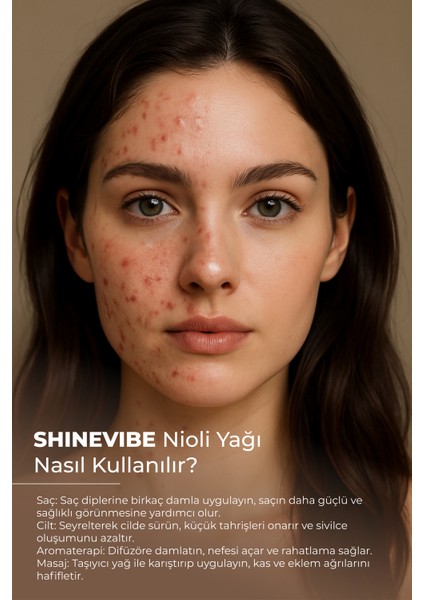 Nioli Yağı 20 ml