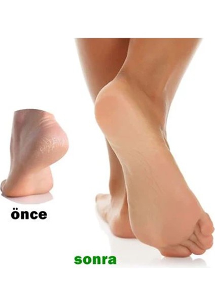 Topuk Törpüsü Set - Ahşap Spatula Sap 100 Adet Yedek Törpü modelleri