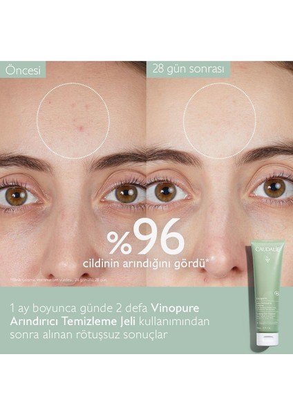 Vinopure Hassas Ciltler için Salisilik Asitli Arındırıcı ve Canlandırıcı Jel Temizleyici 150 ml indirimleri