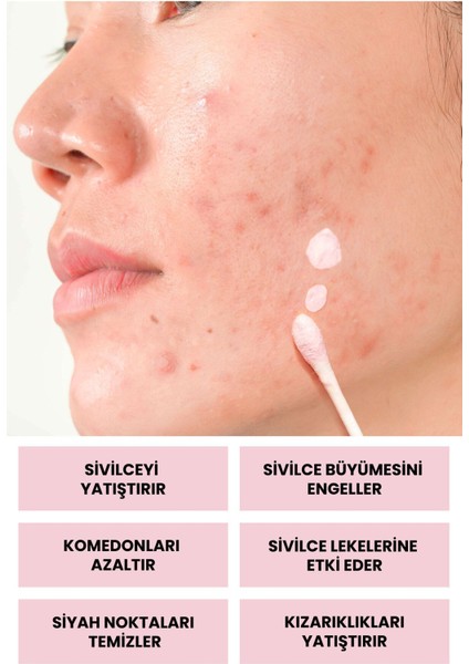 Luv it Losyon - Karma Ciltler İçin Doğal İçeriklerle Cilt Temizleme ve Bakım 30 ml