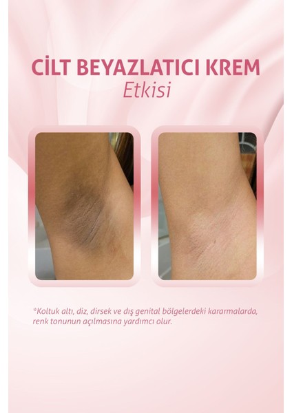 Yüz Jeli - Tüm Cilt Tipleri için Kararma Önleyici, Volkanik Çamur ile Zenginleştirilmiş, Cilt Tonunu Aydınlatan ve Nemlendiren Bakım