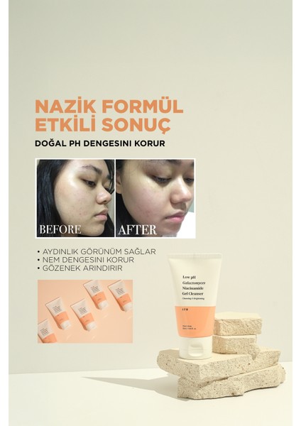 Gözenek Arındırıcı Jel Temizleyici Leke, Akne ve Karşıtı Ph Dengeli Yüz Temizleme Jeli 150ML fırsatları