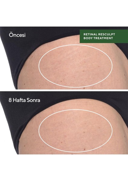 Retinal Resculpt Body Treatment - Retinal İçeren Yenileyici Vücut Bakımı 150ML indirimleri