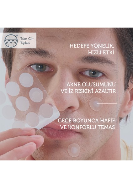 Microneedle Teknolojili Akne Patch, Akne Karşıtı Yama, Mikroiğneli Bant, 9 Adet fiyatları