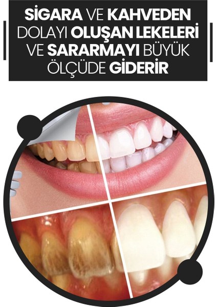 Doğal Diş Beyazlatma Tozu - Kimyasal İçerik Yok, Hindistan Cevizi ve Aktif Karbon ile 50 g fiyatları