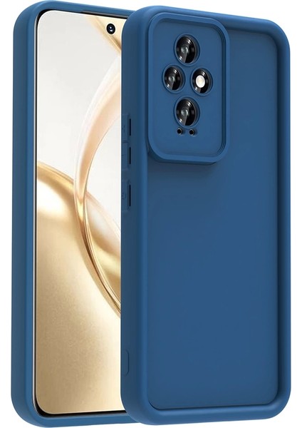 Honor 200 Uyumlu Kılıf Kamera Korumalı Dayanıklı Ananas Kapak