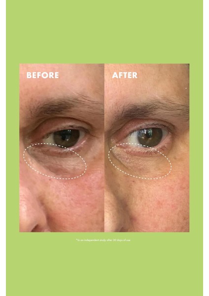 Niacinamide & Caffeine Aydınlatıcı Göz Kremi 15GR indirimleri