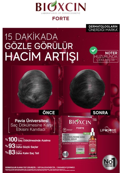 Forte Erkekler için Saç Dökülmesine Karşı Bitkisel Saç Serumu - Lipozom Teknolojisi, 3 x 50 ml