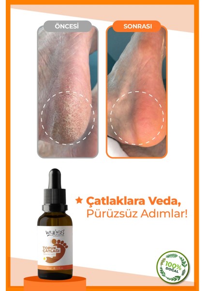 Doğal İçerikli Ayak ve Topuk Bakım Yağı - Hızla Emilir, 30 ml, Shea Yağı ve E Vitamini İçerir