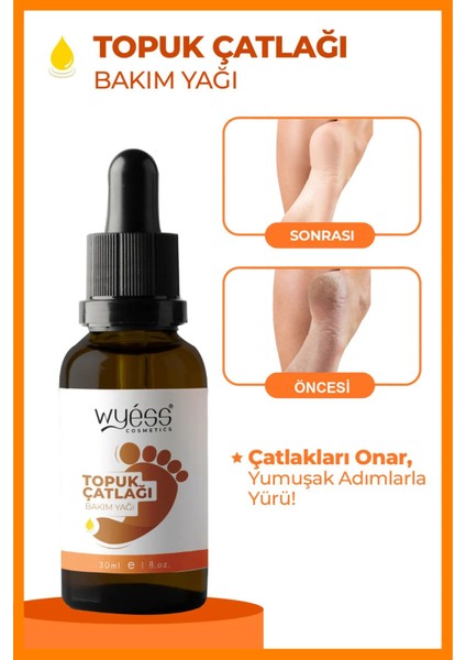 Doğal İçerikli Ayak ve Topuk Bakım Yağı - Hızla Emilir, 30 ml, Shea Yağı ve E Vitamini İçerir
