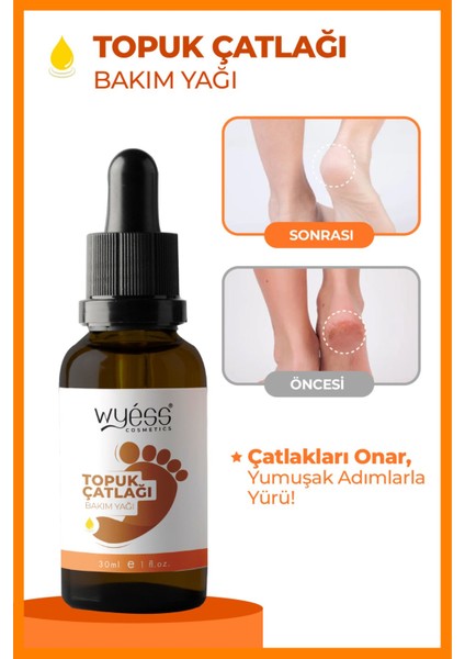 Doğal İçerikli Ayak ve Topuk Bakım Yağı - Hızla Emilir, 30 ml, Shea Yağı ve E Vitamini İçerir