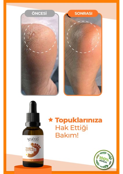 Doğal İçerikli Ayak ve Topuk Bakım Yağı - Hızla Emilir, 30 ml, Shea Yağı ve E Vitamini İçerir