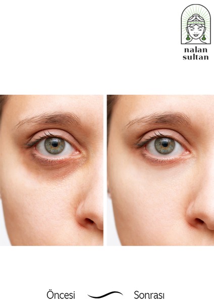 | Göz Bakım Serumu Eye Contour Serum (Morluk, Şişlik & Kaz Ayağı), Yaşlanma Karşıtı, Vegan İçerik (10 ml) fiyatları