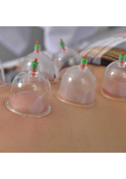 Kupa Çekme Hacamat Seti 6 Adet fiyatları