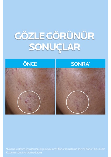 Cilt Bakım Seti 2 Adet Tüm Cilt Tipleri İçin Güneş Koruma ve Derin Temizlik Niacinamide fiyatları
