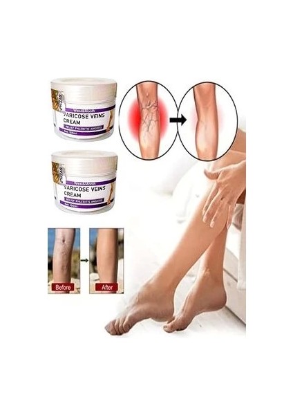 Varicose And Spider Veins Soothing Leg Cream Bacak Bakım Kremi 100 ml x 2 Adet