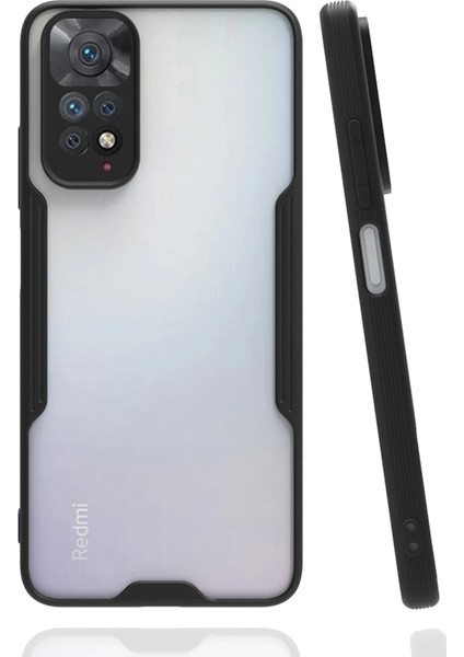 Newface Xiaomi Redmi Note 11 Kılıf Platin Silikon - Siyah