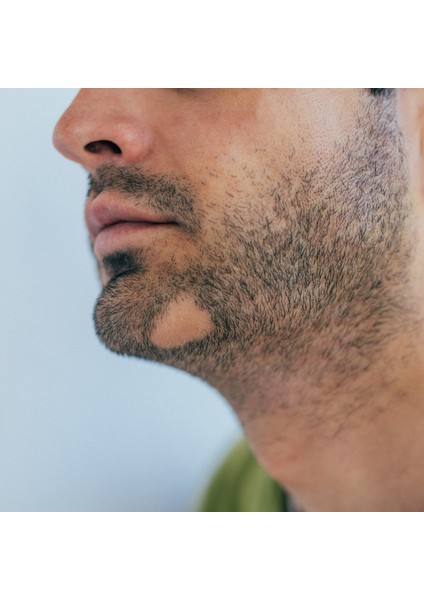 Saç ve Sakal Derisi Özel Bakım Serumu