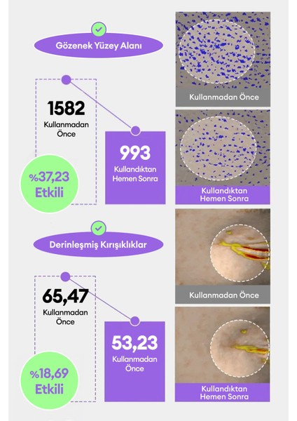 Kırışıklık ve Gözenek Karşıtı Retinol Serum Time Revolution Retinol 1000 Shot Spicule Serum