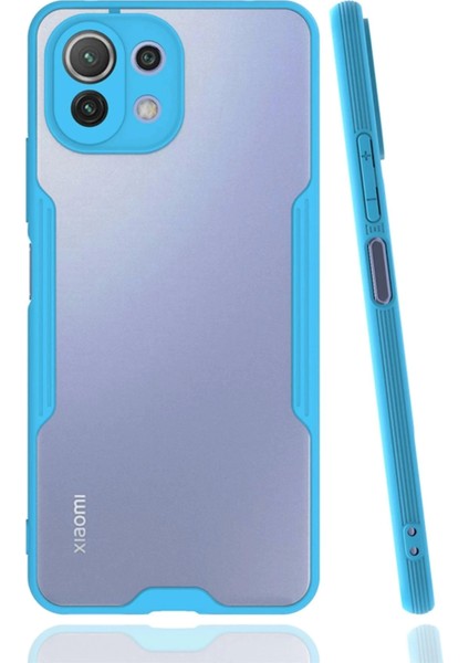 Newface Xiaomi Mi 11 Lite Kılıf Platin Silikon - Mavi