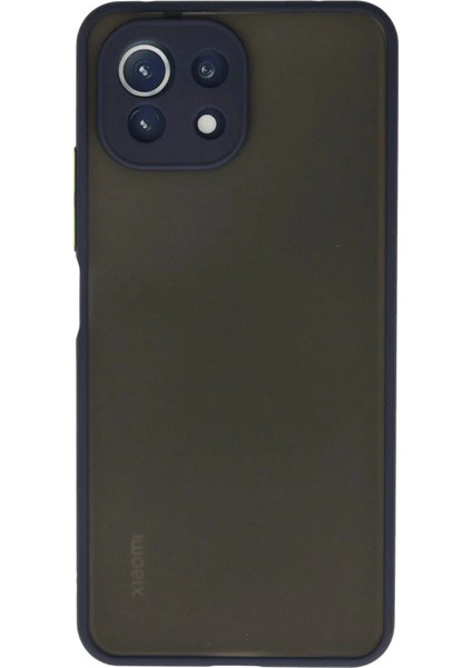 Newface Xiaomi Mi 11 Lite Kılıf Montreal Silikon Kapak - Lacivert