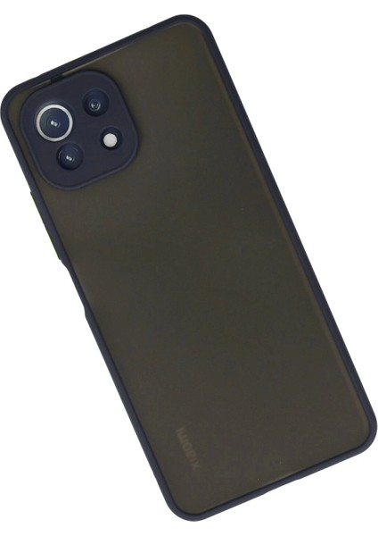 Newface Xiaomi Mi 11 Lite Kılıf Montreal Silikon Kapak - Lacivert fiyatları