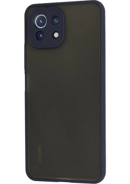 Newface Xiaomi Mi 11 Lite Kılıf Montreal Silikon Kapak - Lacivert modelleri