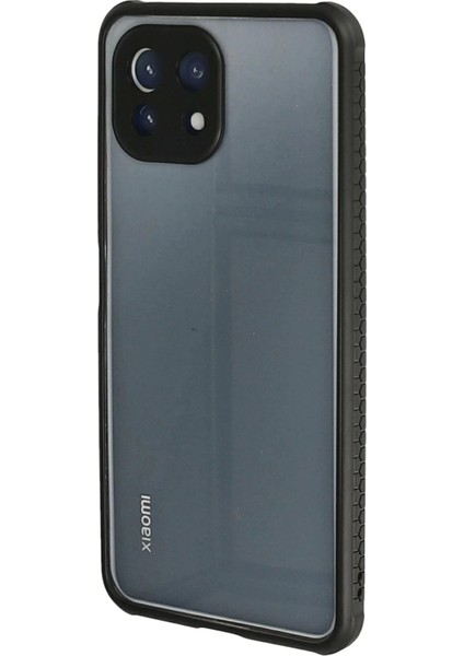 Newface Xiaomi Mi 11 Lite Kılıf Miami Şeffaf Silikon - Siyah modelleri