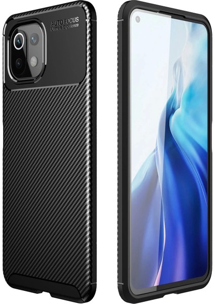 Newface Xiaomi Mi 11 Lite Kılıf Auto Focus Karbon Kapak - Siyah
