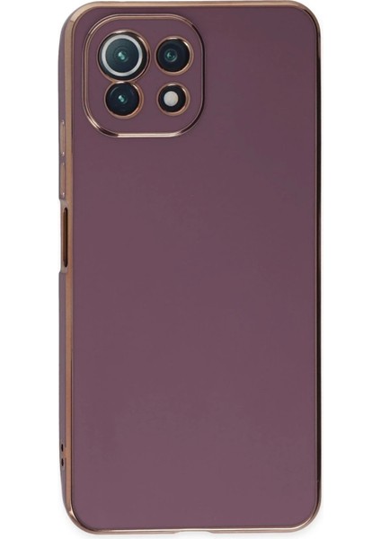 Newface Xiaomi Mi 11 Lite Kılıf Volet Silikon - Mor fiyatları