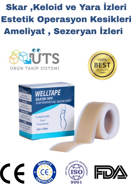 Yaraizi Gidericisilikon Bant 2 Cmx 1,5m