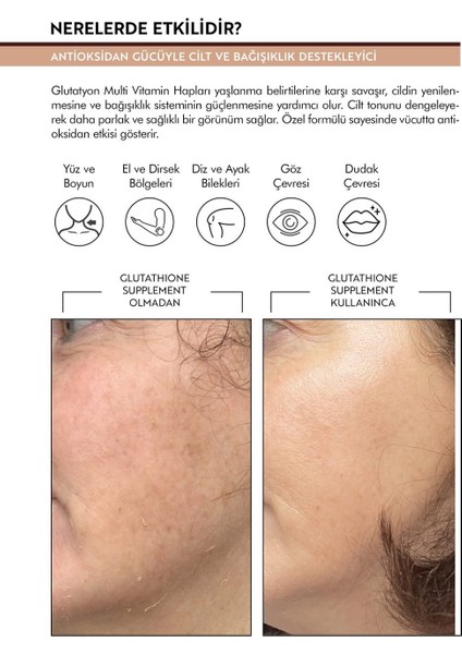 Glutatyon Takviye Edici Gıda 30 Tablet – Antioksidan & Bağışıklık Destekleyici fırsatları