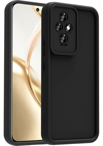 Honor 200 Kılıf Esnek ve Yumuşak Dokulu Telefonu Çizmeyen Soft Silikon Kapak Royal Case/ananas