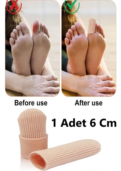 Ayak Başparmak Kemik Koruyucu , Tırnak Batması Için Kumaş Kaplı Silikon Tüp Yara Nasır Koruyucu fiyatları