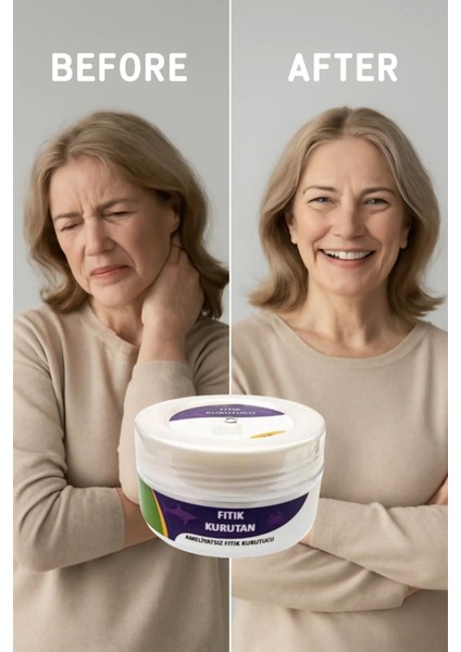 Fıtık Kurutan Krem 50 ml