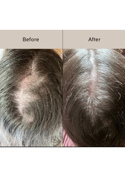 Pitta Growth Serum - Saç Uzatıcı Serum 50 ml modelleri