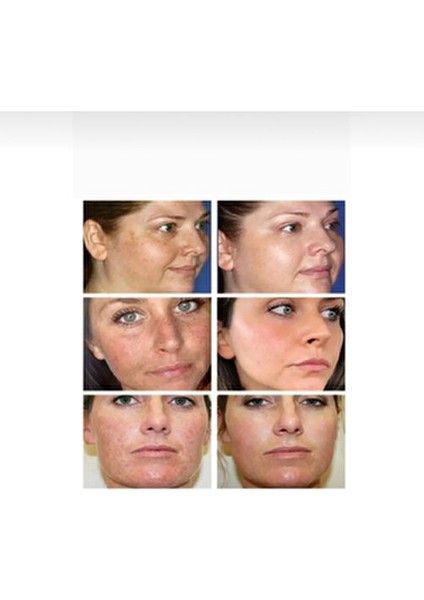 Cilt Beyazlatıcı Krem fiyatları