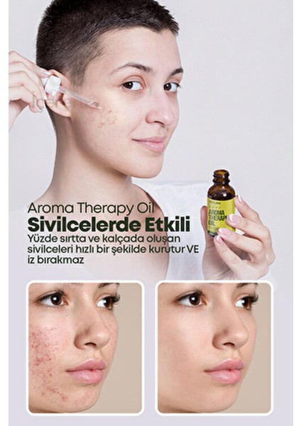 Aroma Therapy Oil Doğal ve Keskin Koku 10 ml Cilt Yanmasına Karşı Etkili indirimleri