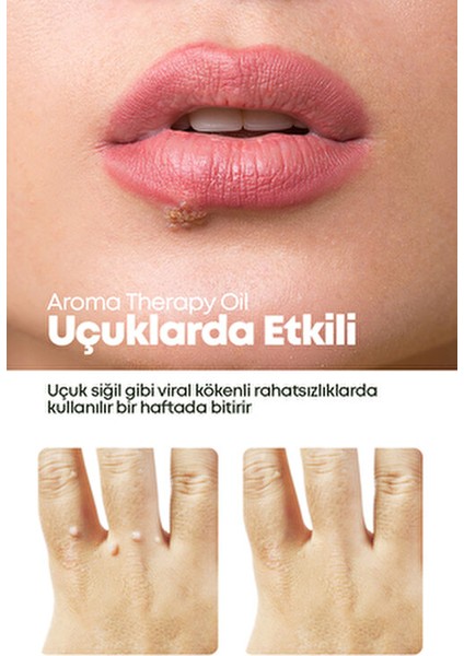 Aroma Therapy Oil Doğal ve Keskin Koku 10 ml Cilt Yanmasına Karşı Etkili