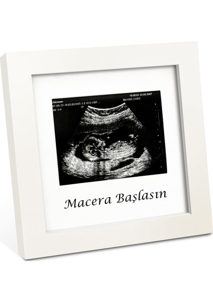 Bebek Ultrason Fotoğraf Çerçevesi 3'lü Triemester, Sonogram Anı Çerçevesi, Yeni Anne Hamile Hediyesi