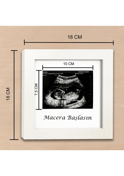 Bebek Ultrason Fotoğraf Çerçevesi 3'lü Triemester, Sonogram Anı Çerçevesi, Yeni Anne Hamile Hediyesi modelleri