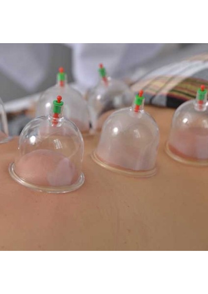 Kupa Çekme Hacamat Seti 6 Adet modelleri